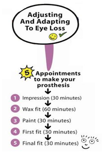Five appointments to make an eye prosthesis
