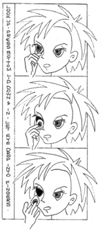 Removing artificial eye without suction cup